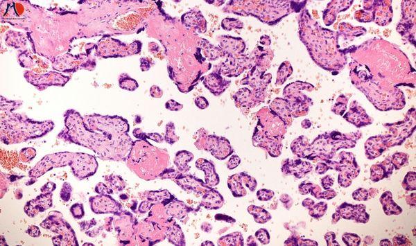 bio-placenta-noi-sinh-giai-phap-tre-hoa-dac-tri-nam-tu-nhat-ban-4.jpg